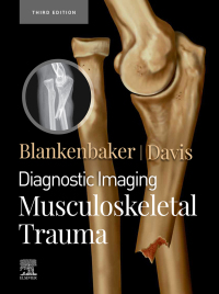 Immagine di copertina: Diagnostic Imaging: Musculoskeletal Trauma,E-Book 3rd edition 9780323793933
