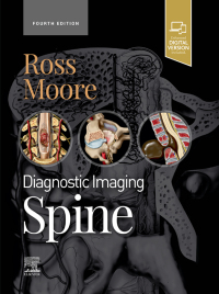 Cover image: Diagnostic Imaging: Spine 4th edition 9780323793995