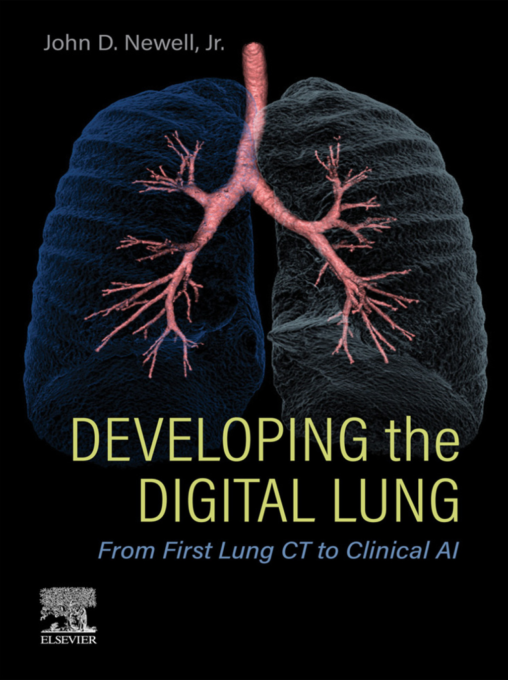 Developing the Digital Lung From First Lung CT to Clinical AI