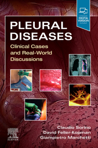 Immagine di copertina: Pleural Diseases 9780323795418