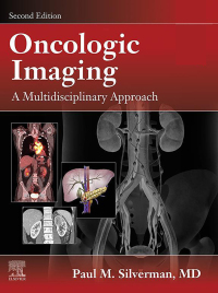 Immagine di copertina: Oncologic Imaging: A Multidisciplinary Approach E-Book 2nd edition 9780323695381