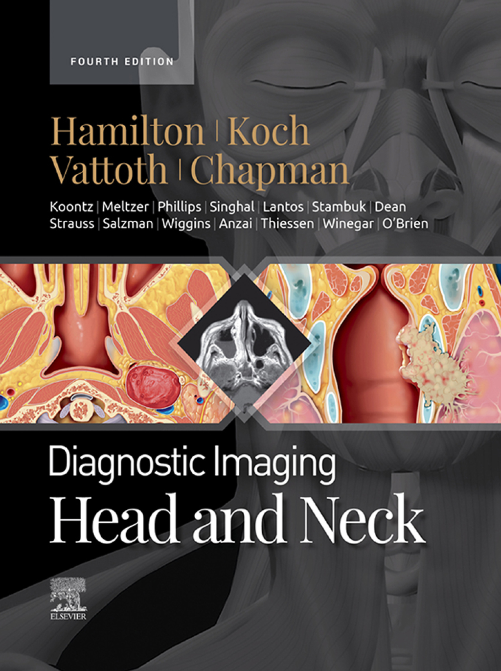 Diagnostic Imaging: Head and Neck – E-Book 4th Edition
    Newer Edition Available