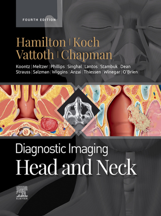 Immagine di copertina: Diagnostic Imaging: Head and Neck - E-Book 4th edition 9780323796507