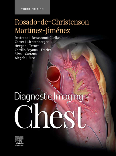 Diagnostic Imaging: Chest - E-Book, 3rd Edition - FULL INSTANT DOWNLOAD | PDF DOCX EPUB