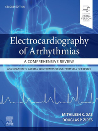 Immagine di copertina: Electrocardiography of Arrhythmias: A Comprehensive Review 2nd edition 9780323680509