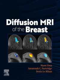 Immagine di copertina: DIFFUSION MRI OF THE BREAST, E-Book 9780323797023