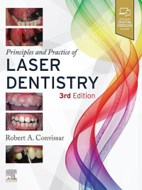 Cover image: Principles and Practice of Laser Dentistry 3rd edition 9780323812832