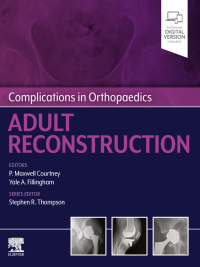 表紙画像: Complications in Orthopaedics: Adult Reconstruction - E-Book 9780323824378