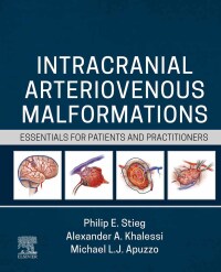 Cover image: Intracranial Arteriovenous Malformations 9780323825306