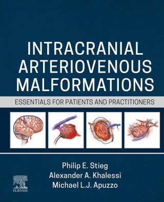 Imagen de portada: Intracranial Arteriovenous Malformations 1st edition 9780323825306