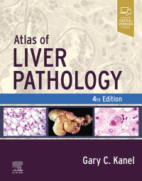 Cover image: Atlas of Liver Pathology 4th edition 9780323825337