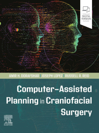 Cover image: Computer-Assisted Planning in Craniofacial Surgery 9780323826686