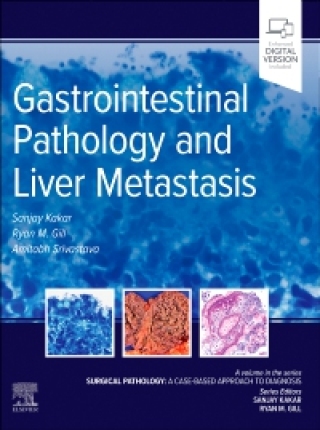Cover image: Gastrointestinal Pathology and Liver Metastasis: A Case-Based Approach to Diagnosis 1st edition 9780323826884