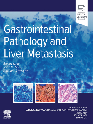 Imagen de portada: Gastrointestinal Pathology and Liver Metastasis :A Case-Based Approach to Diagnosis 9780323826884