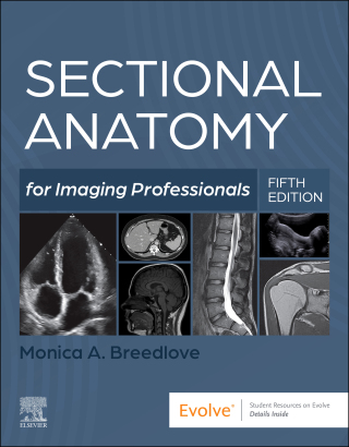 Cover image: Sectional Anatomy for Imaging Professionals 5th edition 9780323827881