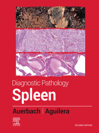 Immagine di copertina: Diagnostic Pathology: Spleen - E-Book 2nd edition 9780323830126