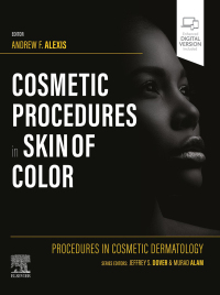 Titelbild: Procedures in Cosmetic Dermatology: Cosmetic Procedures in Skin of Color 9780323831444