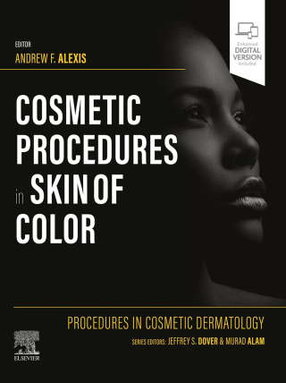 Cover image: Procedures in Cosmetic Dermatology: Cosmetic Procedures in Skin of Color 9780323831444