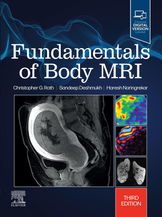 Cover image: Fundamentals of Body MRI 3rd edition 9780323833813