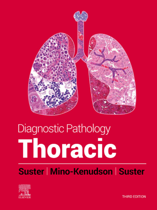 Imagen de portada: Diagnostic Pathology: Thoracic - E-Book 3rd edition 9780323834766
