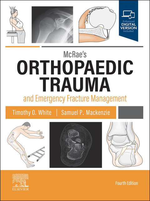 McRae's Orthopaedic Trauma and Emergency Fracture Management, 4th Edition - FULL INSTANT DOWNLOAD | PDF DOCX EPUB