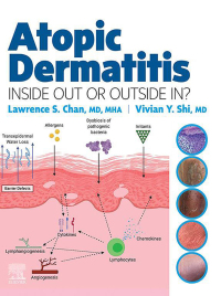 Titelbild: Atopic Dermatitis: Inside Out or Outside In - E-Book 9780323847445