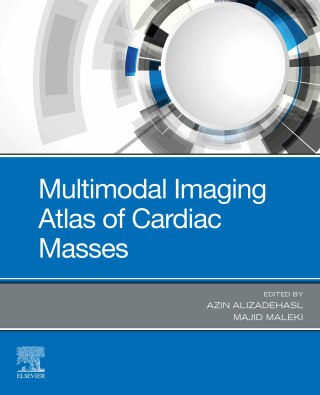 表紙画像: Multimodal Imaging Atlas of Cardiac Masses 1st edition 9780323849067