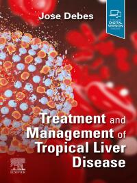 表紙画像: Treatment and Management of Tropical Liver Disease 1st edition 9780323870313