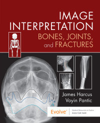 صورة الغلاف: Image Interpretation: Bones, Joints, and Fractures 9780323870801
