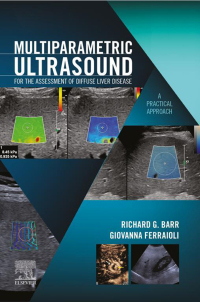صورة الغلاف: Multiparametric Ultrasound for the Assessment of Diffuse Liver Disease 1st edition 9780323874793