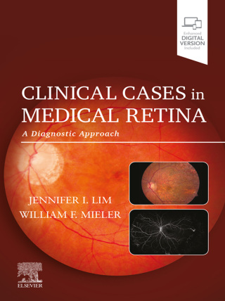 Cover image: Clinical Cases in Medical Retina 9780128227206