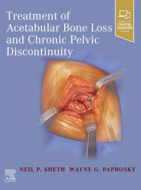 Cover image: Treatment of Acetabular Bone Loss and Chronic Pelvic Discontinuity 9780323875509