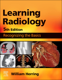 Cover image: Learning Radiology 5th edition 9780323878173