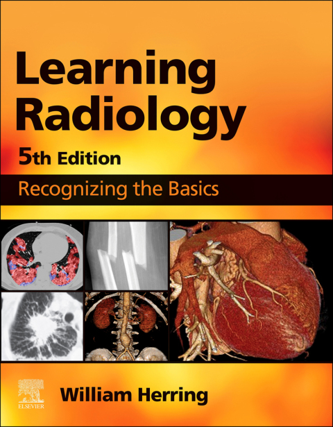 Learning Radiology: Recognizing the Basics, 5th Edition - FULL INSTANT DOWNLOAD | PDF DOCX EPUB
