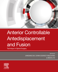 Cover image: Anterior Controllable Antedisplacement and Fusion (ACAF) 1st edition 9780323880497