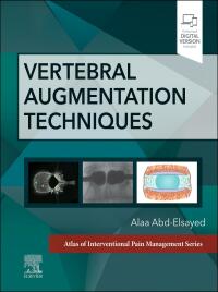 Cover image: Vertebral Augmentation Techniques 1st edition 9780323882262