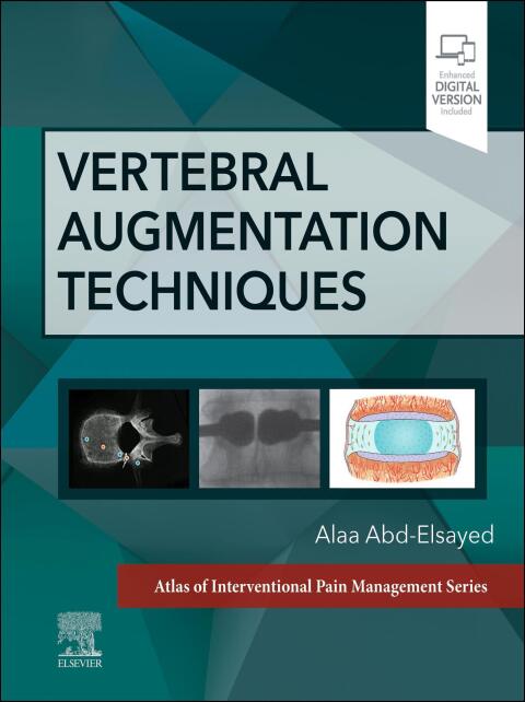 Vertebral Augmentation Techniques, 1st Edition - FULL INSTANT DOWNLOAD | PDF DOCX EPUB