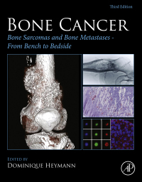 Cover image: Bone Cancer 3rd edition 9780128216668