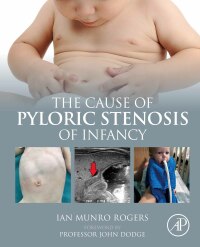 Imagen de portada: The Cause of Pyloric Stenosis of Infancy 9780323897761