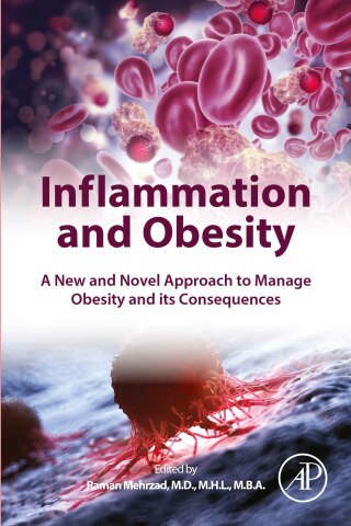 表紙画像: Inflammation and Obesity 1st edition 9780323909600