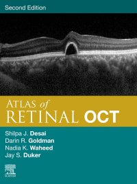 Titelbild: Atlas of Retinal OCT: Optical Coherence Tomography 2nd edition 9780323930437