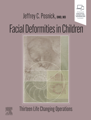 Cover image: Facial Deformities in Children 9780323932394