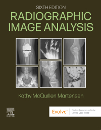 Cover image: Radiographic Image Analysis 6th edition 9780323930697