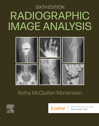 Cover image: Radiographic Image Analysis 6th edition 9780323930697