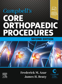 Titelbild: Campbell's Core Orthopaedic Procedures 2nd edition 9780323934572