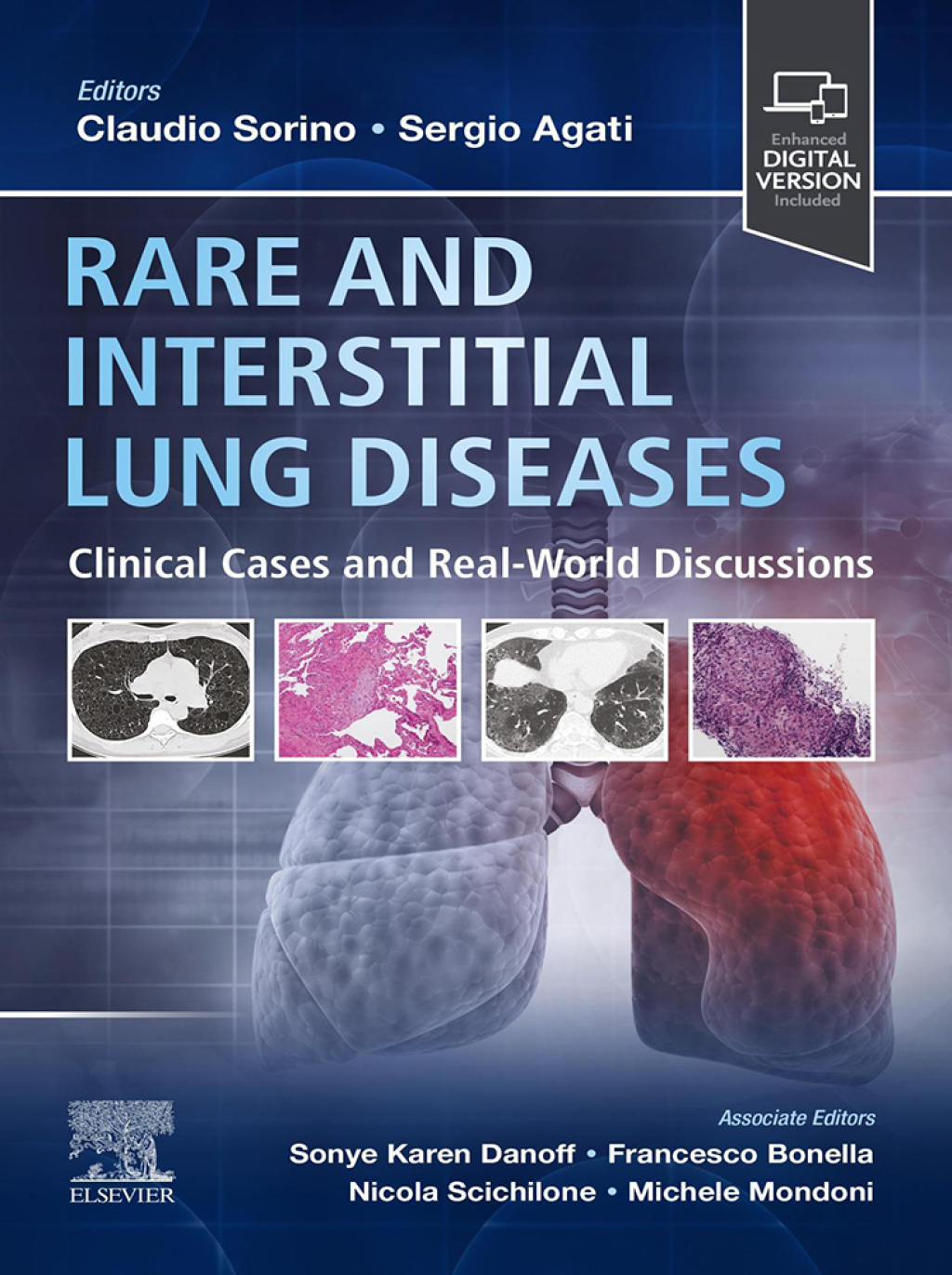 Rare and Interstitial Lung Diseases Clinical Cases and Real-World Discussions 1st Edition