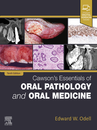 Immagine di copertina: Cawson's Essentials of Oral Pathology and Oral Medicine 10th edition 9780323935494
