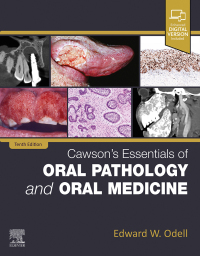 Cover image: Cawson's Essentials of Oral Pathology and Oral Medicine 10th edition 9780323935494