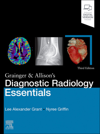 Cover image: Grainger & Allison's Diagnostic Radiology Essentials 3rd edition 9780323936057