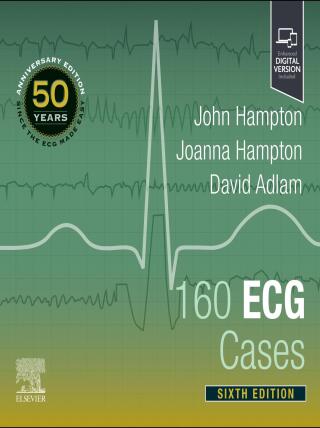 Cover image: 160 ECG Cases 6th edition 9780323937658